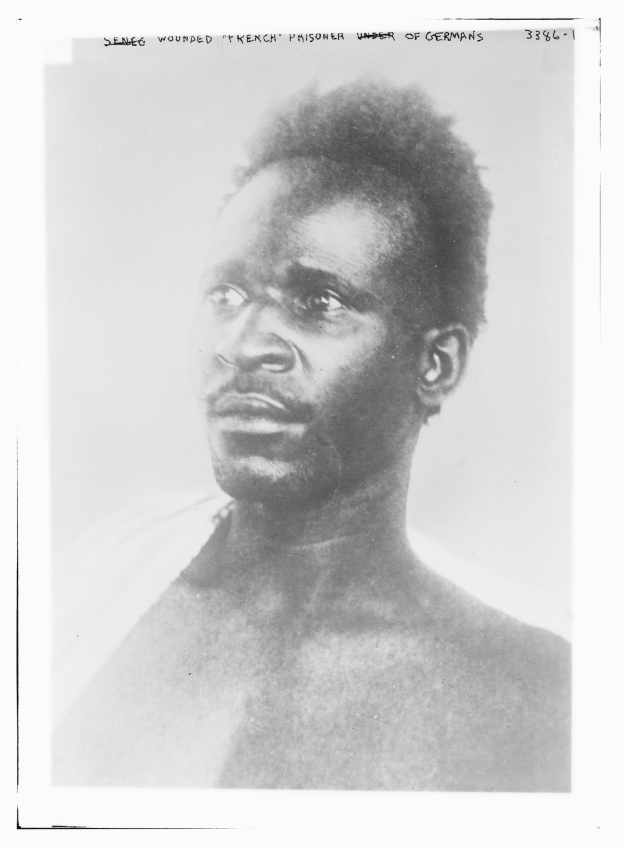 Schwarzes und weißes Foto eines Mannes mit ernstem Gesichtsausdruck, beschriftet mit "Seneg Verletzter französischer Gefangener unter Deutschen" oben.